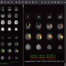 제이엘케이(JLK) 이미지
