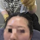웰킨 천호점 | 탈모에 진심인 사람이 웰킨두피탈모센터 송파문정점 다녀온 솔직후기