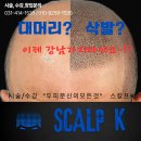 서지원 | 안산두피문신 비용부터 유지기간까지 직접 받아본 후기