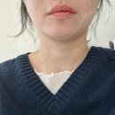 닥터봄춘의원 | 대전올타이트리프팅 키닥터선정된 권원장님 이중턱 리얼 후기