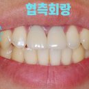 서울페이스21치과의원 네이버블로그