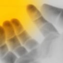 분당한의원 이미지