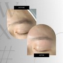 더블유엑스# | 은평구 웨딩왁싱 페이스왁싱 잘하는곳 더블유엑스샵&왁싱 후기