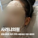 바른케어의원 | 사려니의원 | 편평사마귀 내돈내산 후기+취소표 예약 방법 총정리 (비용 포함)