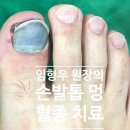 멍발머리 이미지