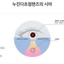 아이셀렉트안경 이미지