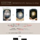 이오스타 이미지