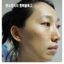리히트:빛 이미지