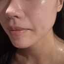 쑥뜸마을 | 봉담피부관리 물방울리프팅 후기_오행쑥뜸