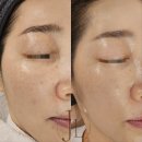 제이엘타워(JL타워) | [청라 에스테틱]쫀쫀토닝 출시 1개월!_제이엘뷰티