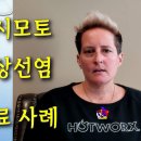 하시모토 갑상선염 치료 사례 - 비과학적 양의학 157 - 사암침, 사암침법 이미지