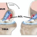 전방십자인대 파열 부상 주의... 이미지