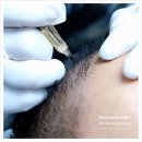 풍성풍성두피