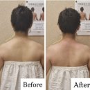 리센츠약국 | 잠실피부관리 추천 위뷰티 잠실점 WE목피부관리(승모근마시지) 후기