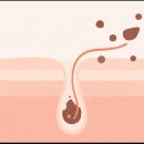 일산차앤박피부과의원 | 고양 피부과 의원 잘하는 곳 찾는다면?