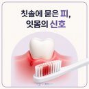 힘찬플란트치과의원 | 수원치과, 양치 시 피나는 잇몸 검진의 중요성