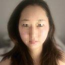 상나운1길 | 군산 레이드 스킨 솔직 체험기