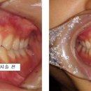 마이크로치과기공소 이미지