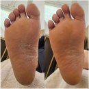 세븐일레븐 대림88타워점 | 대림 신풍역 발각질 건조한 발 관리는 여기, 네일샵에스대림점