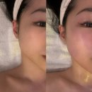 쌍문동 피부관리 이지원스킨&amp;바디왁싱 미백 탄력관리 후기