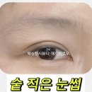 애드브로우