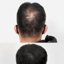 리게인프로젝트 부산점 이미지