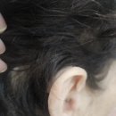봉동제일여성경로당 | 군산보청기 - 👂 70대 어머님 시그니아 퓨어 C&amp;G AX 착용 후기