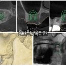 신흥치과기공소 이미지