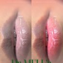 2096 | 남양주 마석에서 색소침착 고민이라면? 닥터멜라 멜라닌케어 시작하세요 – 오늘은미쁨