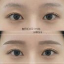 여우눈썹