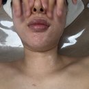 혜리케어 | 대전 피부관리 잘하는 곳 도안동 혜리쌀롱에서 윤곽관리 받은 후기