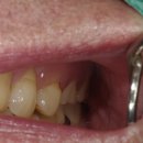 영치과기공소 이미지