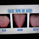 오장육부를 담은 혀/몸속 진액 늘리는 침샘 폭발 차/기치유센터 이미지