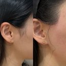 수하뷰티 | 청량리왁싱 [수하왁싱앤뷰티] 구렛나루 슈가링왁싱 예민한 얇은 피부 후기