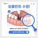 교대역인앤인오피스 | 임플란트 수명 연장 방법 총정리 수술부터 관리까지