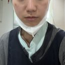 서울뷰의원 | 내돈내산 서울 여의도 데이뷰의원 슈링크*쥬베룩*이마보톡스 피부시술 기록