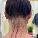 깔끔한 헤어라인 정리 깔끔한 뒷목정리를 원한다면 양서경뷰티끌리네왁싱 전주점 전주왁싱