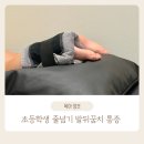 호평동 통증의학과 아이 줄넘기 뒤꿈치 통증 방문