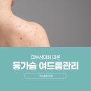 제제한의원 | 시청역가슴여드름, 여드름 한의원 치료는 어떤 방식으로 진행될까요?
