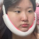 비앤디 앤모드 내돈내산 후기 : 사용법과 주의해야할 점