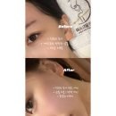 인천타워대로 197번길 | 인천 송도 피부관리 ‘목미인골드스파’ 윤곽 | 리프팅 관리로 V라인 &amp; 앞볼 채움 효과 후기