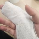 연세기쁨정형외과의원 | 고속터미널역 정형외과 열린연세정형외과의원｜갑자기 부은 검지손가락 진료 후기
