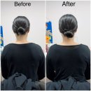 플라베스 | 이동림프관리 플라베스 림프순환 윤곽관리 후기