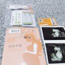 김효정소아과의원 | 송파 고은빛 산부인과에서 임신 확진, 임신 6주 :)