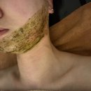 동광메디칼 | 창원 메르씨에스테틱 문제성피부 잡아주는 곳