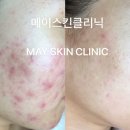 메이 스킨클리닉