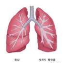 서울대학교 외래암센터내 네이버블로그