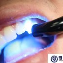 개봉치과의원 네이버블로그
