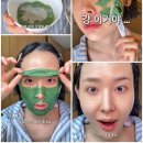 혜니알, 피부과 관리 후 진정 관리 루틴💚