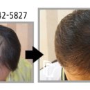 드림헤어라인의원 이미지